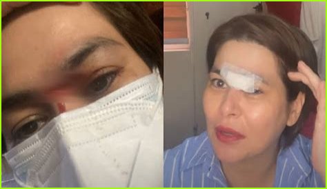 Filipina actress needed stitches after eating spicy ramen